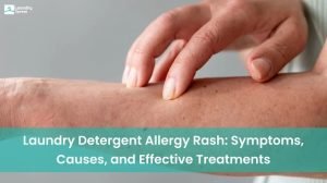 causes, sysmptoms and effective treatments for laundry detergent allergy rash