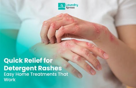 Quick relief from detergent rashes